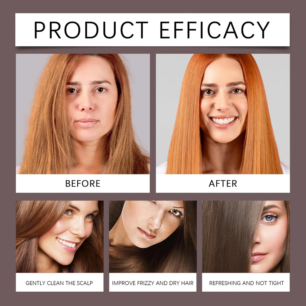 3-in-1 Red Onion Shampoo Black Seed Oil Hair Care Shampoo Hair Care Gentle Cleansing Nourish Scalp Refreshing Shampoo